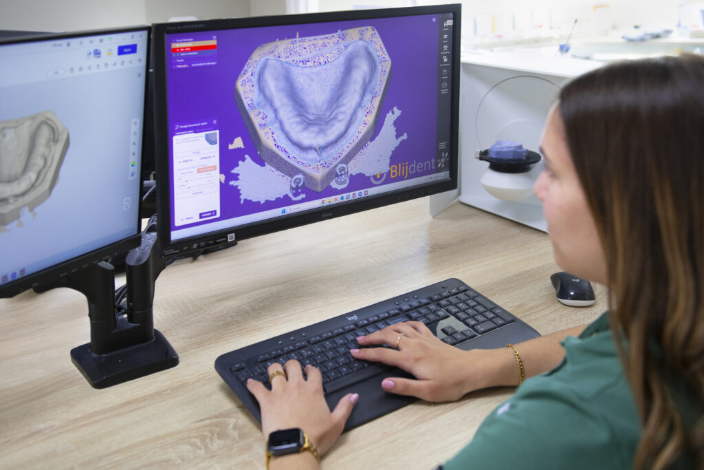 Tandprotheticus werkt aan digitaal ontwerp van gebitsprothese op computer met gespecialiseerde software